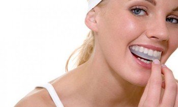 Dantų balinimas kapomis